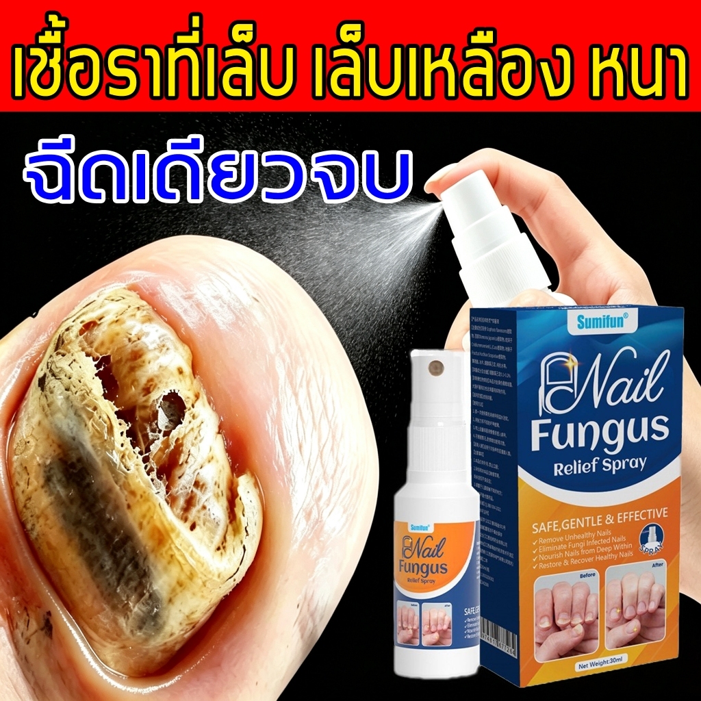 เซรั่มเล็บ รักษาเชื้อราเล็บ ฟื้นฟูเล็บที่เสียหาย ปลอดภัย อ่อนโยน ไม่ระคายเคือง ขนาดกะทัดรัด พกพาสะดวก ใช้งานง่าย 30ml