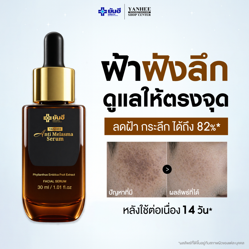 Yanhee Anti Melasma Serum ยันฮี แอนตี้ เมลาสมา เซรั่ม| ฝ้า กระ จุดด่างดำ เหมาะสำหรับผิวแพ้ง่าย