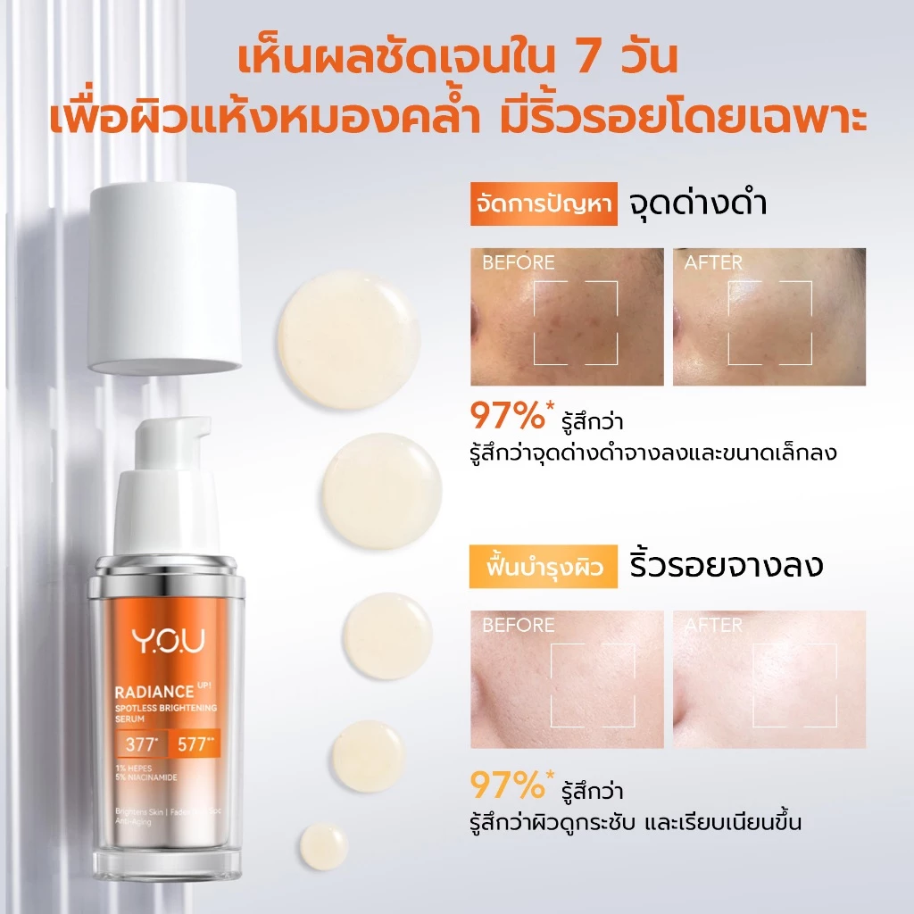 YOU Radiance Up! Spotless Brightening Serum 20ml เซรั่มไวท์เทนนิ่ง วิตามินซี ปรับสีผิวสม่ำเสมอ ผิวอิ่มฟู thumbnail 5