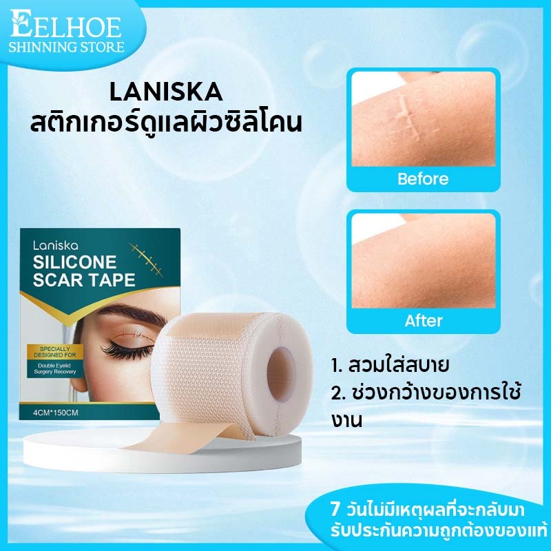 Laniska แผ่นแปะ ซิลิโคน ลดรอยแผลเป็น แผ่นแปะแผลเป็น แผ่นซิลิโคนแปะแผลเป็น ซิลิโคนแปะแผลเป็นแผ่นแปะแผ