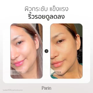 Parin Firming Treatment Gel ยกกระชับผิวหน้า ปรับกระชับรูปหน้าให้เรียวเล็ก หน้าวี