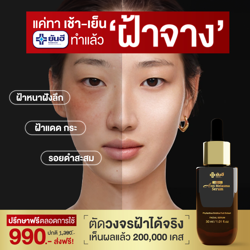 YANHEE ANTI MELASMA ยันฮี เซรั่ม แอนตี้ เมลาสม่า เซรั่ม รักษา ฝ้าหนา ฝ้าแดด จุดด่างดำ ของแท้100% — صورة 7