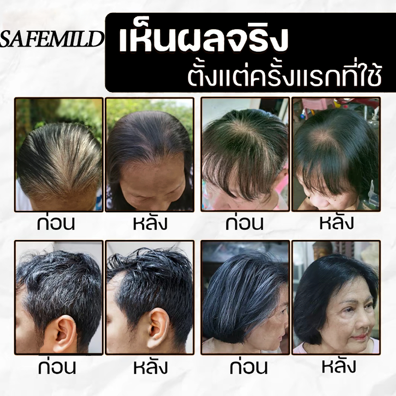 SAFEMILD แชมพูสมุนไพรโบราณ แก้ปัญหาผมร่วง ทำให้ผมขาวกลับมาดำ บำรุงผมด้วยส่วนผสมจากธรรมชาติ Y9-25 - รูปที่ 2