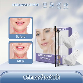 ​OUHOE แผ่นยกกระชับหน้าเร่งด่วน 5 นาทีได้รูปหน้า เรียวV กันน…