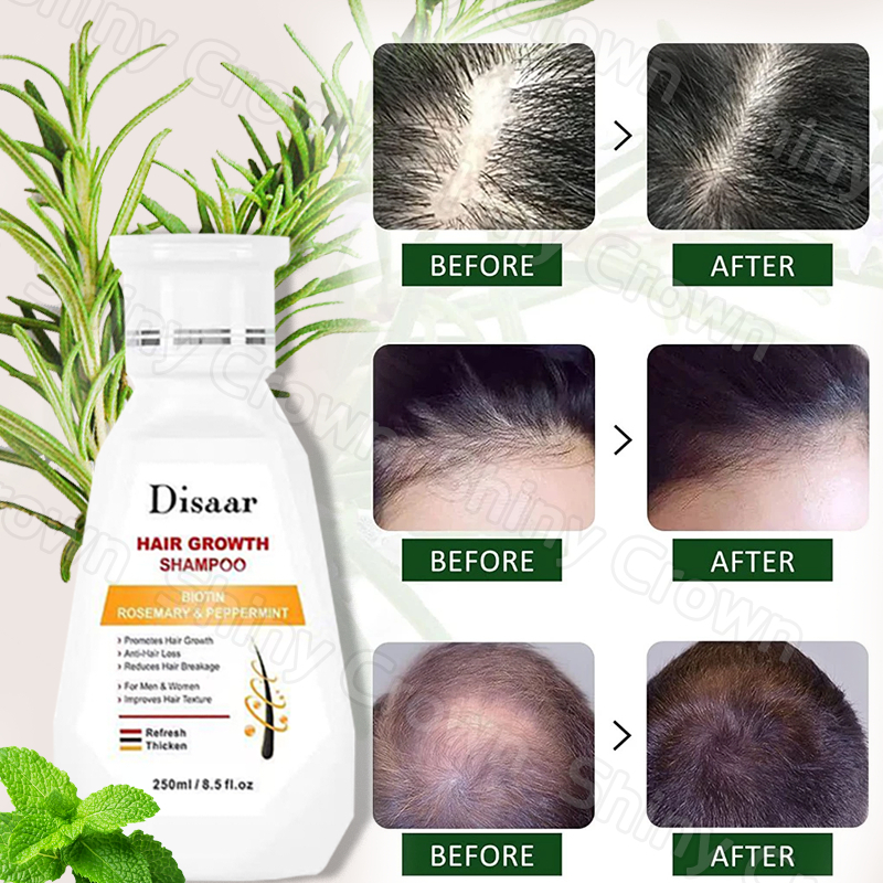 COD New DHT Hair Growth Shampoo 500ml. 2 ขวด สินค้าแท้จากอเมริกา