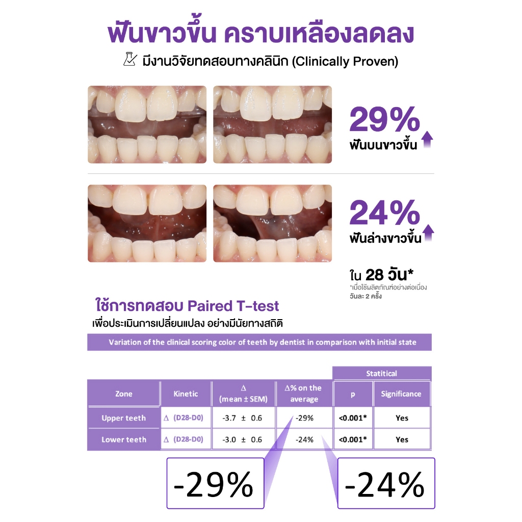 jasmeen ยาสีฟันฟอกฟันขาว ลดคราบเหลือง ปากสะอาด เพอร์เพิล รูปที่ 6
