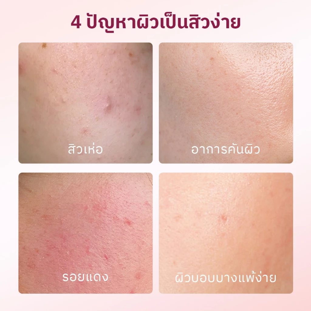 [แพ็คคู่] The Originote Hyalucera Moisturizer +Brightening Moisturizer มอยส์เจอร์ไรเซอร์ - 2