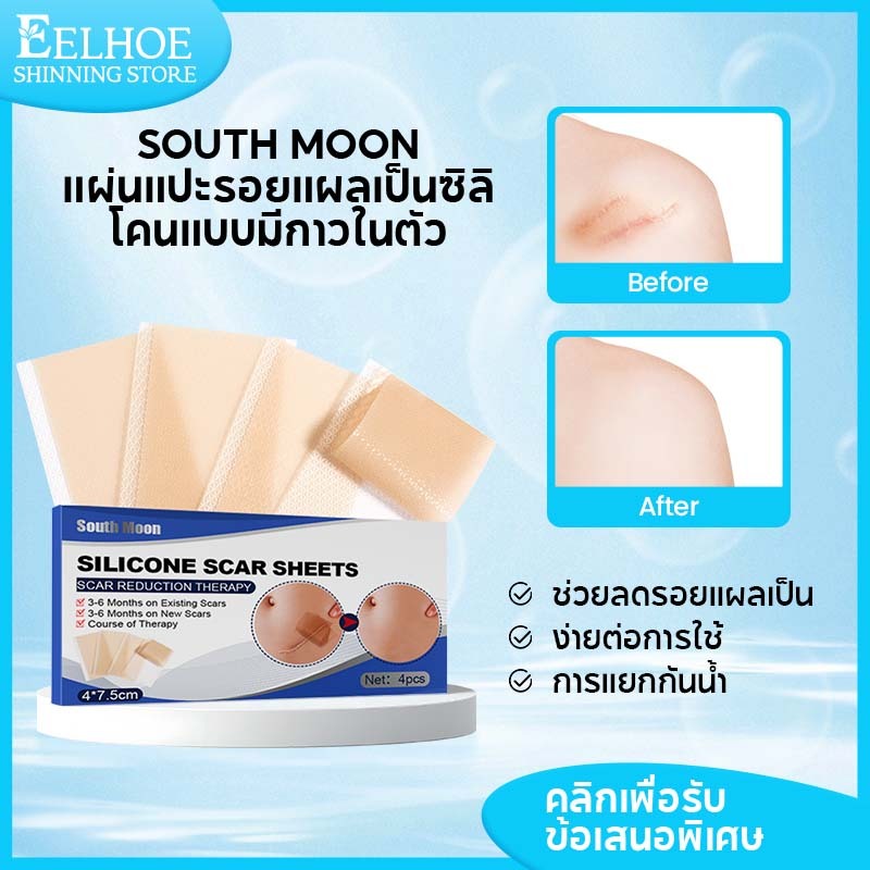 South Moonซิลิโคนแปะแผลเป็น แผ่นแปะแผลเป็น แผ่นแปะ ซิลิโคน ลดรอยแผลเป็น แผ่นแปะ แผลเป็น คีลอยด์ ซิลิ