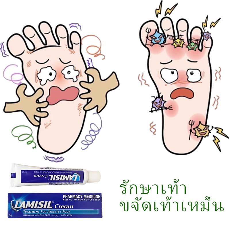 ครีมลดกลิ่นเท้า 【ประสิทธิภาพดี เห็นผลเร็ว】 แก้ไขปัญหาเท้า ระงับกลิ่นเท้า