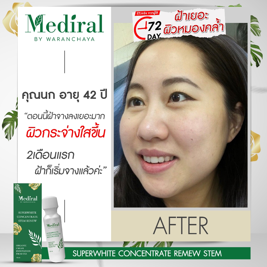 (ส่งฟรี ส่งไว!) Mediral Super White สูตรเร่งด่วน ช่วยลดฝ้า กระ รอยสิว ผิวใสขึ้นใน 7 วัน ราคา ถูกที่สุด ดีลบีเคเค แกลเลอรีภาพที่ 6