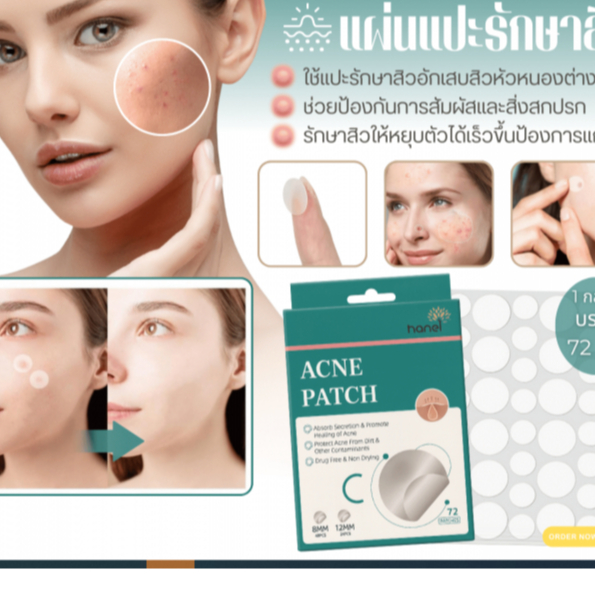 ACNE PATCH แผ่นแปะรักษาสิวมีหลายขนาดให้เลือกใช้ตามขนาดของสิวในจุดต่าง ๆ  -1 กล่องบรรจุ 72 ชิ้น