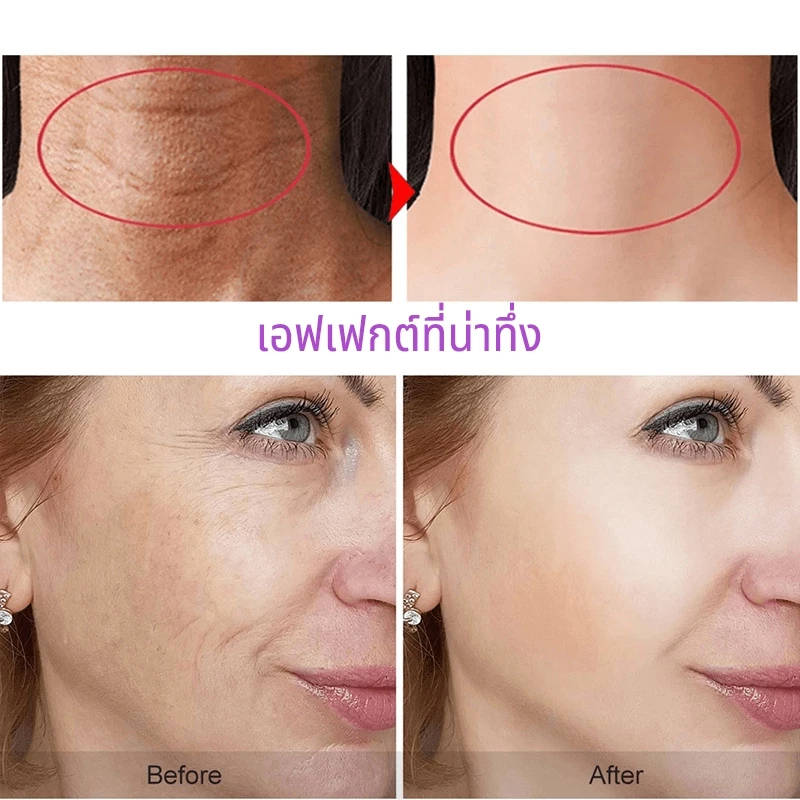 ครีมทาหน้า ครีมริ้วรอย ลดริ้วรอยครีมทาหน้า 50g ต่อต้านริ้วรอย ครีมหน้าใส ครีมลดริ้วรอย กระชับ ยกกระชับ และซ่อมแซมผิว - รูปที่ 6