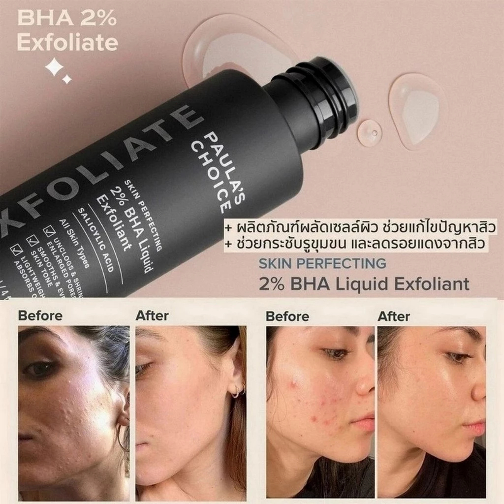 【ของแท้】Paula’s Choice 2% BHA เซรั่ม 118ml ลดสิวเสี้ยน สิวอุดตัน รูขุมขน สำหรับผิวมัน