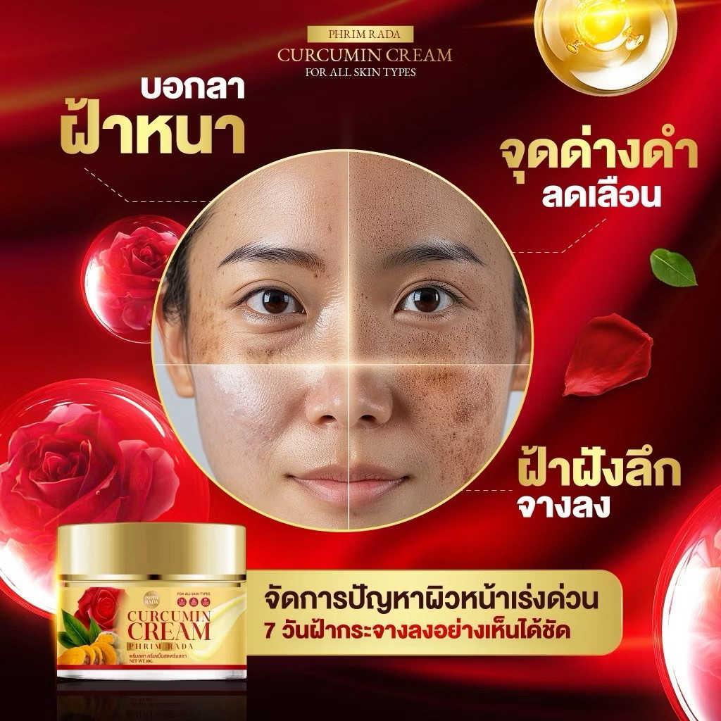 1แถม1ครีมขมิ้นกุหลาบสด บอกลาฝ้าหนา ลดเลือนริ้วรอย ปกป้องผิวจากมลภาวะ - รูปที่ 3