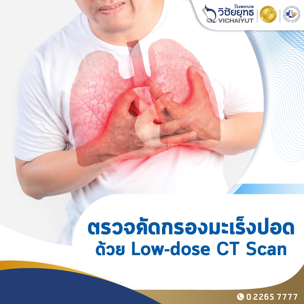 [E-Coupon] รพ.วิชัยยุทธ - โปรแกรมตรวจคัดกรองมะเร็งปอด Low-dose CT Scan