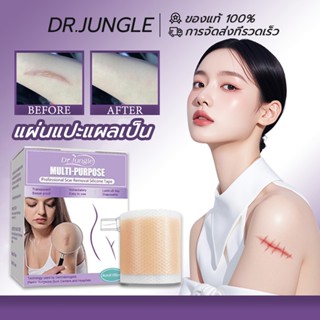 【จัดส่งทัน✨】Dr.Jungle แผ่นแปะแผลเป็น แผ่นซิลิโคนเจล รักษารอย…