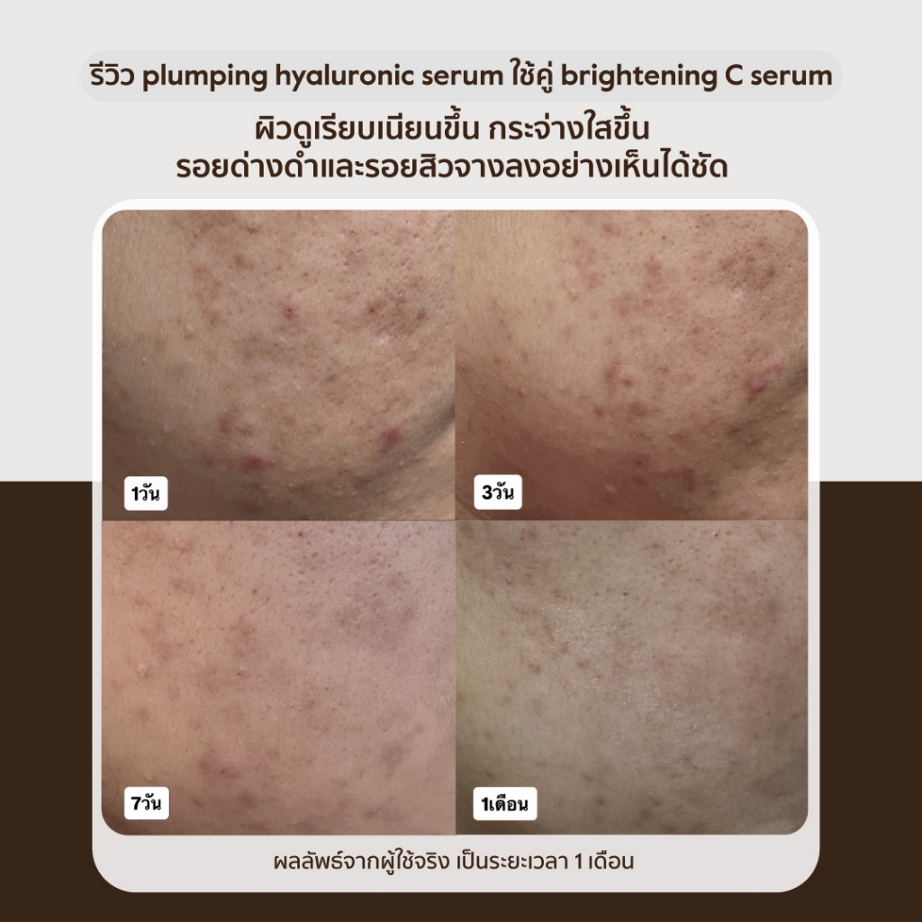 [แถมฟรี! มาส์ก] endota Plumping Hyaluronic Serum เซรั่มเพื่อผิวกระชับเต่งตึง ลดเลือนริ้วรอย 30ml (สูตรใหม่ของ Pe ราคา ถูกที่สุด ดีลบีเคเค แกลเลอรีภาพที่ 9