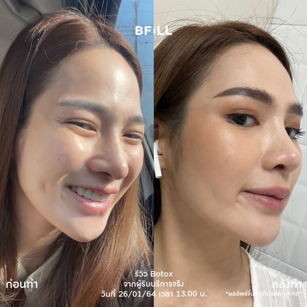 รูปภาพ 3