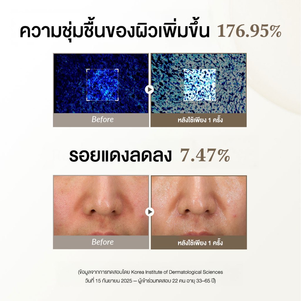 DR.ALTHEA 345 RELIEF CREAM MASK x4 ชิ้น (25G x 4pcs.) ชีทมาสก์ช่วยปลอบประโลมผิวที่ระคายเคืองทันที - รูปที่ 4