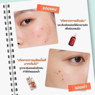 [ซอง] MILLE ACNE POWER SHOT INTENSIVE SERUM 10ml. มิลเล่ เซรั่ม