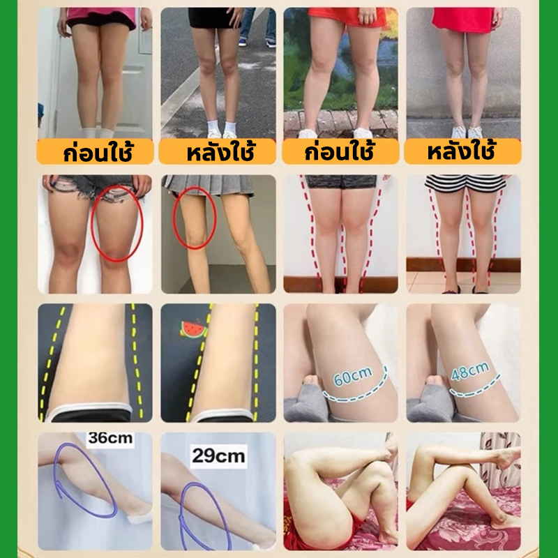 ✨ของแท้✨ South Moon แผ่นแปะลดต้นขา ครีมลดไขมัน แผ่นแปะลดต้นแขนและต้นขา ลดต้นขาใหญ่  กําจัดไขมันต้นขา - รูปที่ 2