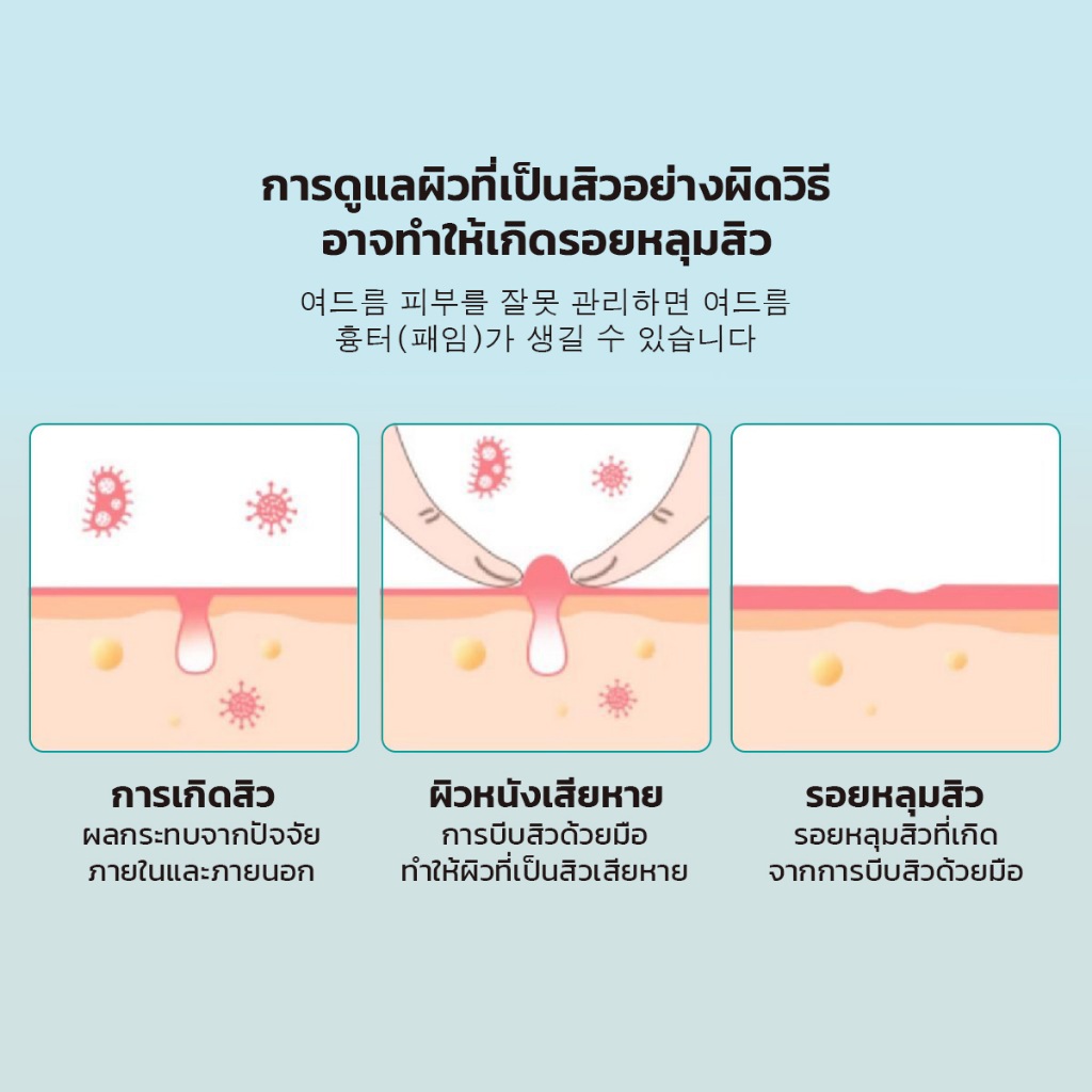 Shimanto لاصقات حب الشباب مقاومة للماء والعرق — صورة 8