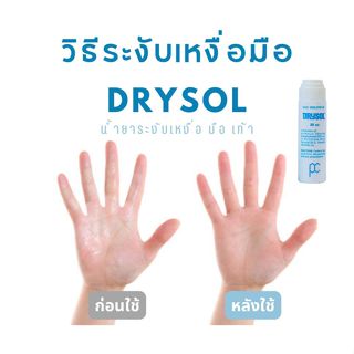 Drysol Antiperspirant น้ำยาระงับเหงื่อสำหรับมือและเท้า 35cc