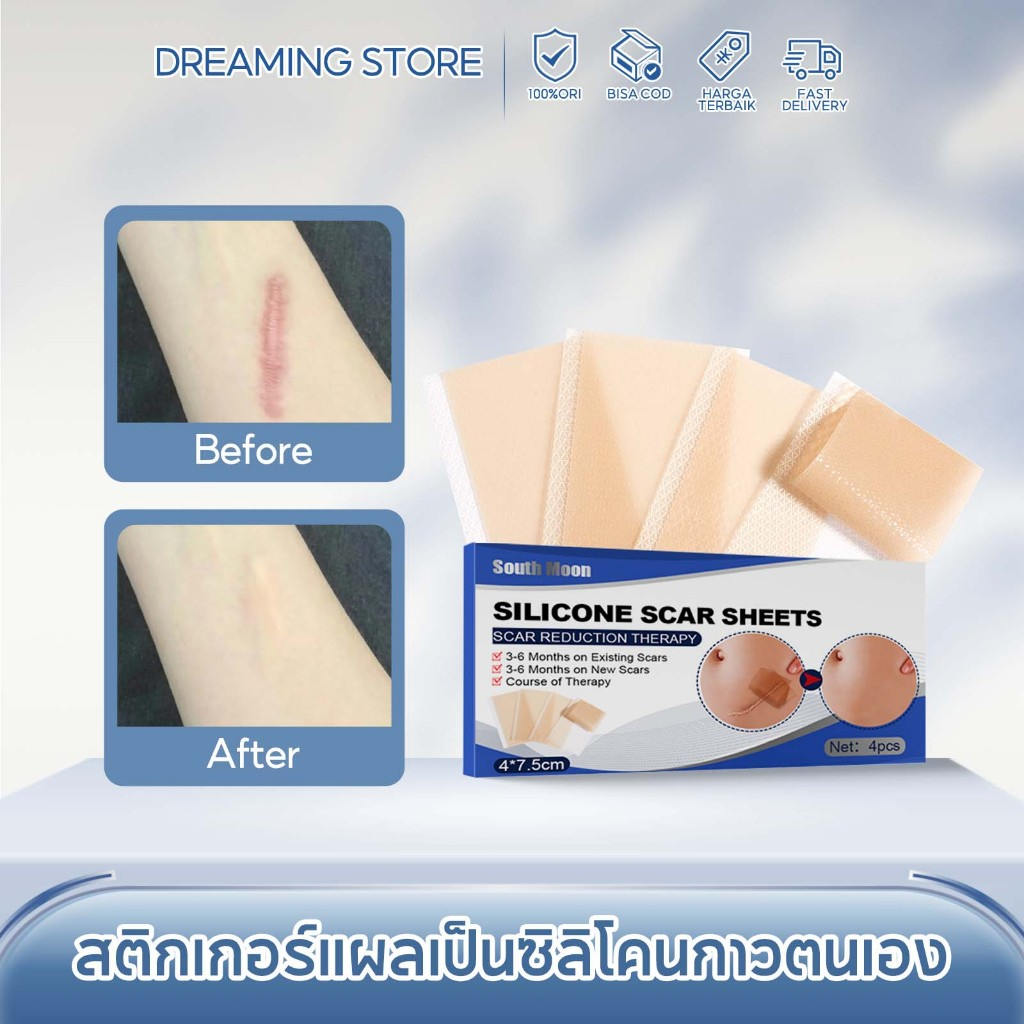 South Moon แผ่นซิลิโคนสำหรับแผลเป็น กันน้ำ แผ่นแปะแผลเป็น ลดทอนรอยแผลเป็นสิว แผลผ่าตัด เรียบเนียน รักษารอยแผลเป็น 4แผ่น