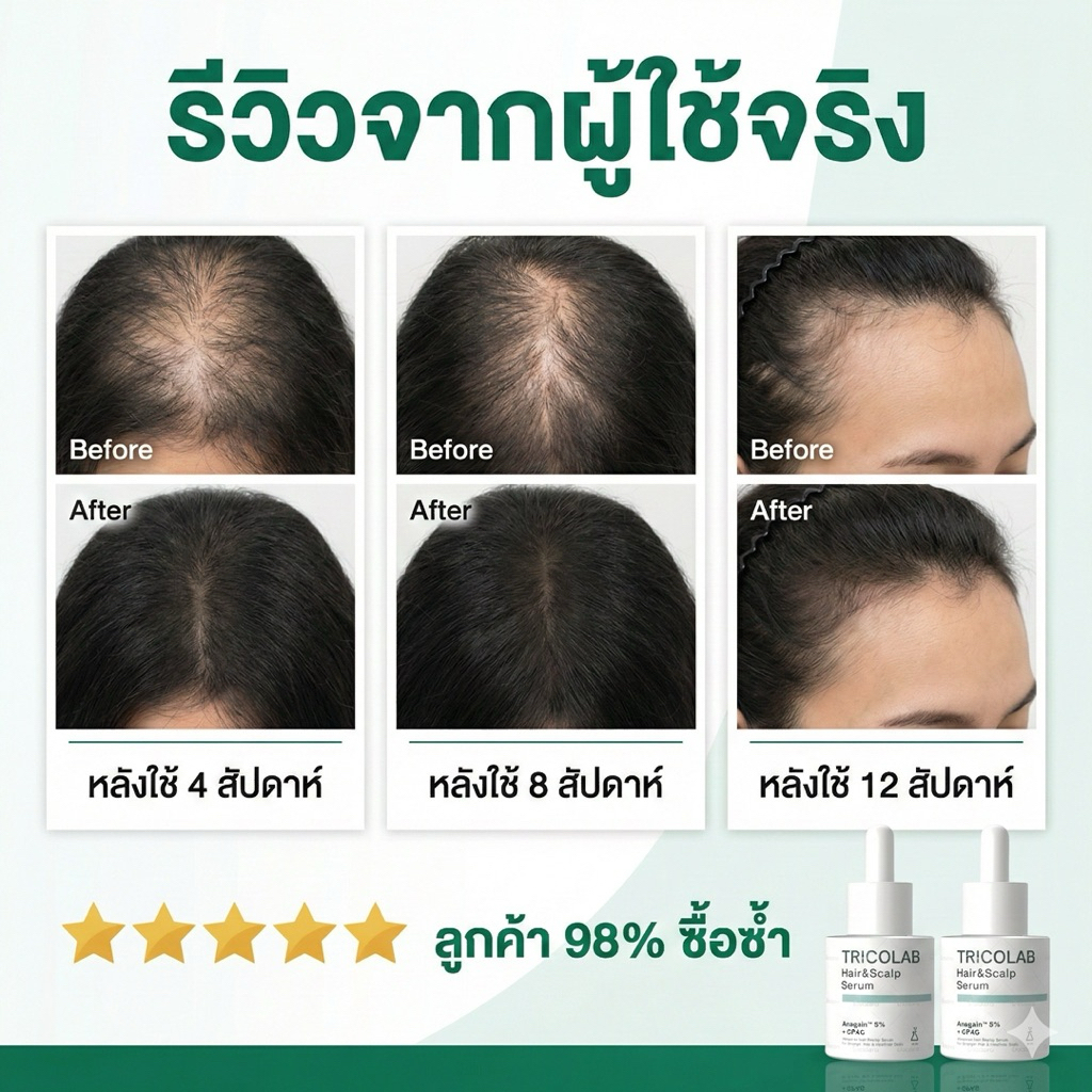 TRICOLAB 1 ขวด เซรั่มลดผมร่วง สูตรเข้มข้น Anagain 2.5% บำรุงรากผม กระตุ้นผมเกิดใหม่  (30ml)