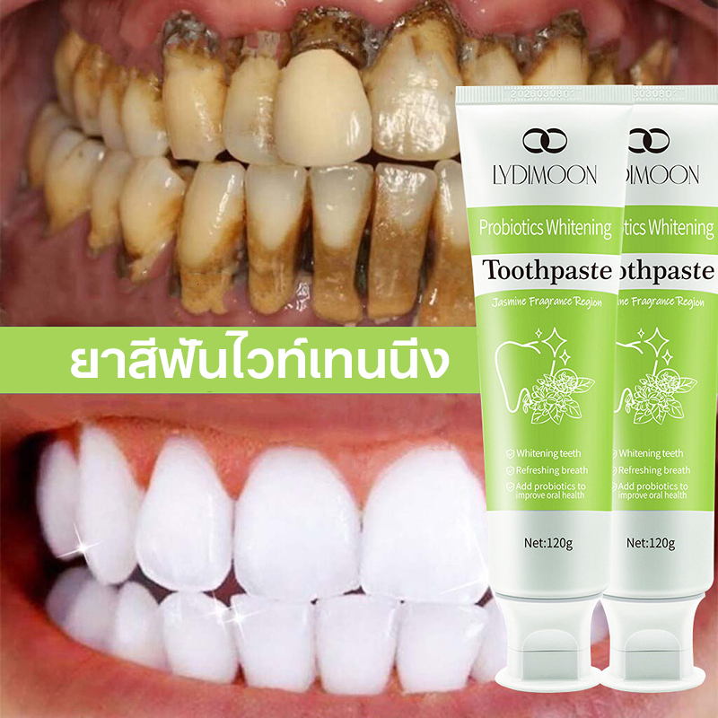 LYDIMOON ยาสีฟันฟอกฟันขาว ยาสีฟันฟันขาว ยาสีฟันโปรไบโอติก 120g ขจัดคราบเหลือง ฟอกสีฟัน ขจัดคราบพลัค 