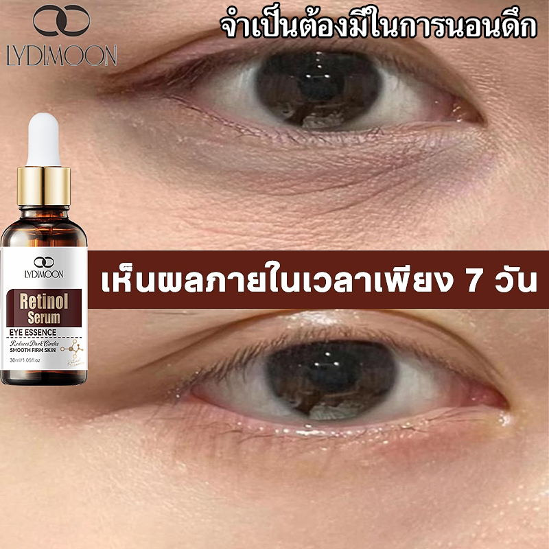 อายเซรั่ม Eye serum เรตินอลเซรั่มบำรุงใต้ตา อายครีม 30ml ลดริ้วรอย ลดขอบตาดํา ลดถุงน้ำใต้ตา ลดริ้วรอยตีนกา ยกกระชับ
