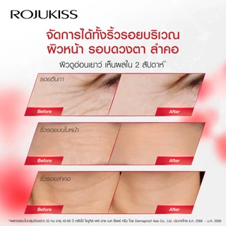 ROJUKISS Face Eye Neck Repair Serum 30ml โรจูคิส เซรั่มยกกระชับ ยืดหยุ่น บำรุงริ้วรอยผิว หน้า ตา คอ