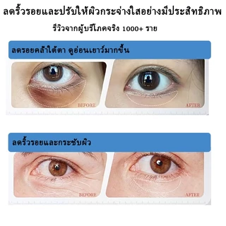 เรตินอลอายครีม ครีมทาใต้ตา Eye Cream Anti-Aging อายครีม35g ลดริ้วรอย ลดถุงน้ำใต้ตา ลดรอยคล้ําใต้ตา ลดริ้วรอยตีนกา ให้คว