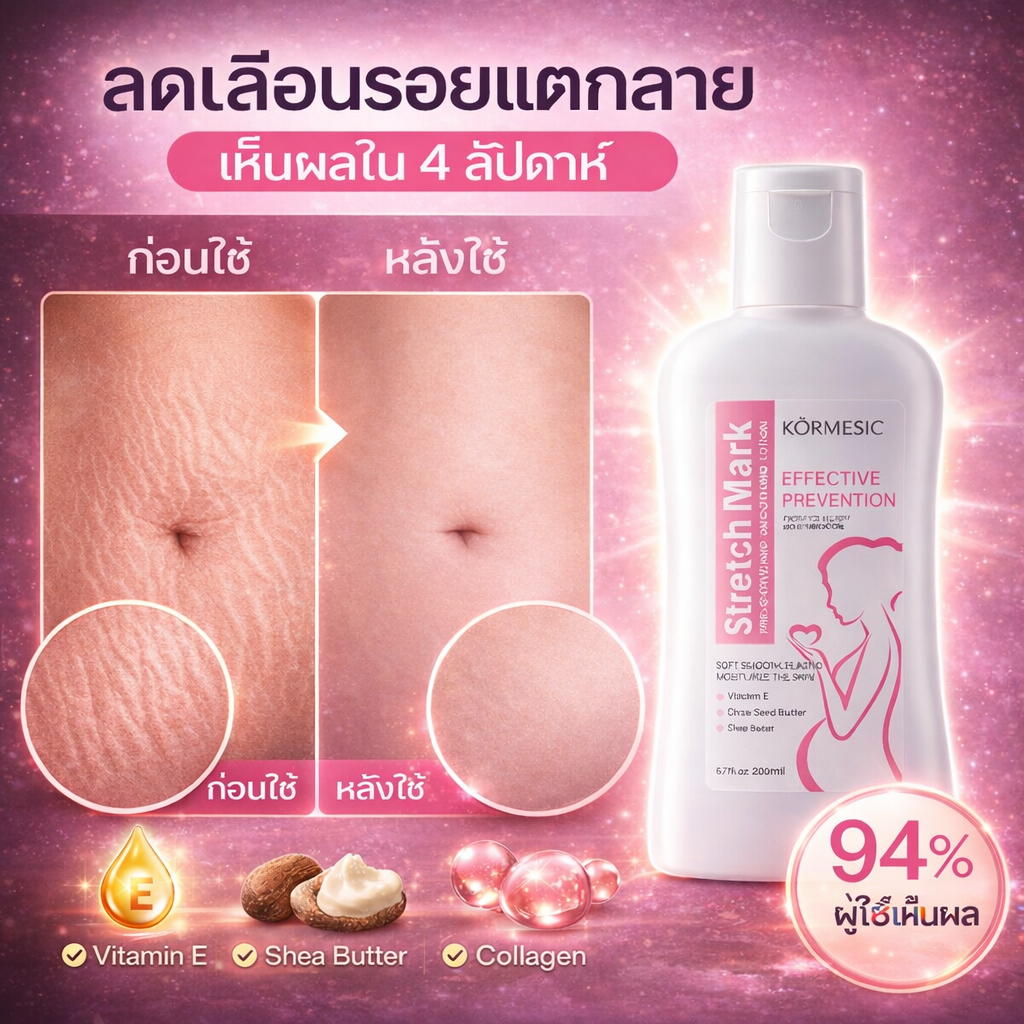 💧 [สูตรอ่อนโยน] 💧ครีมลดรอยแตกลาย บำรุงผิว เพิ่มความชุ่มชื้น ให้ผิวเรียบเนียน และช่วยให้รอยแตกลายดูจางลง