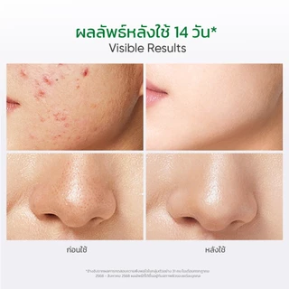 Facerinna Salicylic Acid Acne Toner โทนเนอร์ BHA ผลัดเซลล์ผิว ล้ำลึก ควบคุมความมัน กระชับรูขุมขน ลดสิว เติมชุ่มชื้น