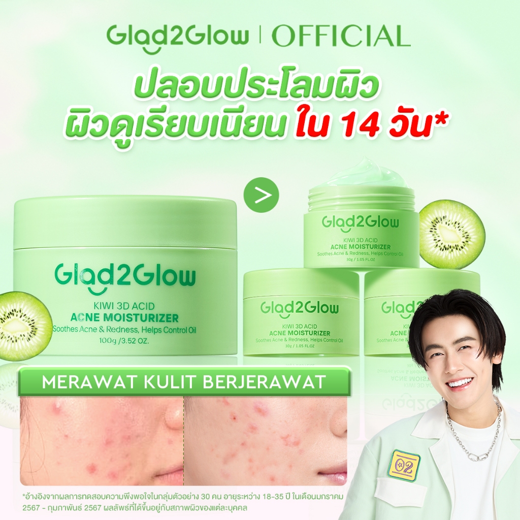 Glad2Glow Kiwi 3D Acid Acne Moisturizer มอยเจอร์ไรเซอร์ ครีม ครีมทาหน้า ลดรอยสิว（ลดรอยสิว）
