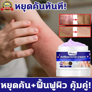 🔥แก้คัฆ่าเชื้อ🔥ครีแก้คัน คันเรื้อง เชื้อรา คันใมผ้า ขาหนีบ เชื้อรา ผื่นกัด Anti-itch cream