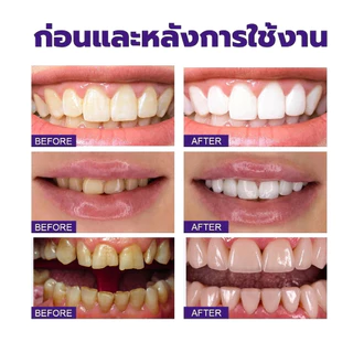 ซื้อ 1 แถม 1 ยาสีฟัน ไวท์เทนนิ่ง ยาสีฟันฟัน สีม่วง กำจัดคราบ ควันบุหรี่ ซ่อมแซมเหงือกและฟันขาว