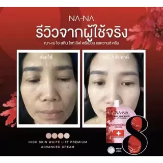 NAWANNA ครีมฟิลเลอร์คุณโจ้ HIGH SKIN WHITE ขนาด 5 กรัม ให้ผิวกระจ่างใส ชุ่มชื้น เนียนนุ่ม