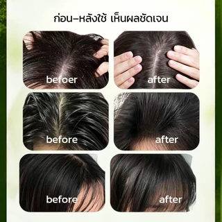 🔥 ส่งฟรี แชมพูกรดอะมิโนผสมเกลือทะเล 500ml | ขจัดรังแค คุมมัน ทำความสะอาดล้ำลึก ผมนุ่มฟู ชุ่มชื้น ✨