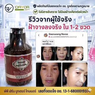 โทนเนอร์เช็ดฝ้า วิตามินสมุนไพร เช็ดฝ้ากระ ผิวกระจ่างใส