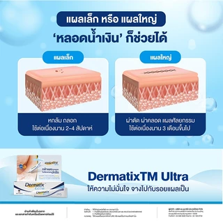 Dermatix Ultra Gel เจลลดรอยแผลเป็น แผลคีรอยด์ แผลเป็นแบบนูน(ตัวเลือก 9g. 15g.)