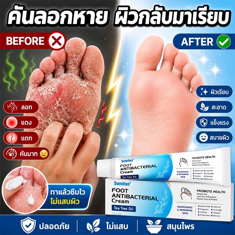 ฆ่าเชื้อโรค ครีมระงับกลิ่นเท้า ครีมทาเท้า บรรเทาคัน ป้องกันเชื้อรา ฟื้นฟูผิวเา ครีมลดกลิ่นเท้า