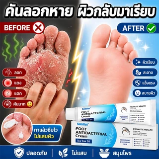ฆ่าเชื้อโรค ครีมระงับกลิ่นเท้า ครีมทาเท้า บรรเทาคัน ป้องกันเชื้อรา ฟื้นฟูผิวเา ครีมลดกลิ่นเท้า
