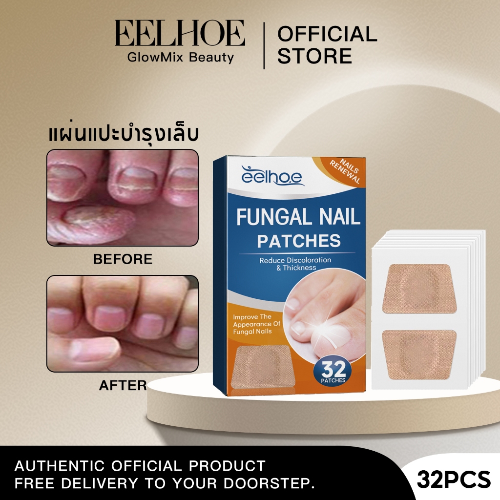 EELHOE แผ่นแปะดูแลเล็บเท้า แผ่นแปะเล็บขบ ติดกันโรคเชื้อราเล็บ เชื้อราลดลง ติดกันเชื้อรา