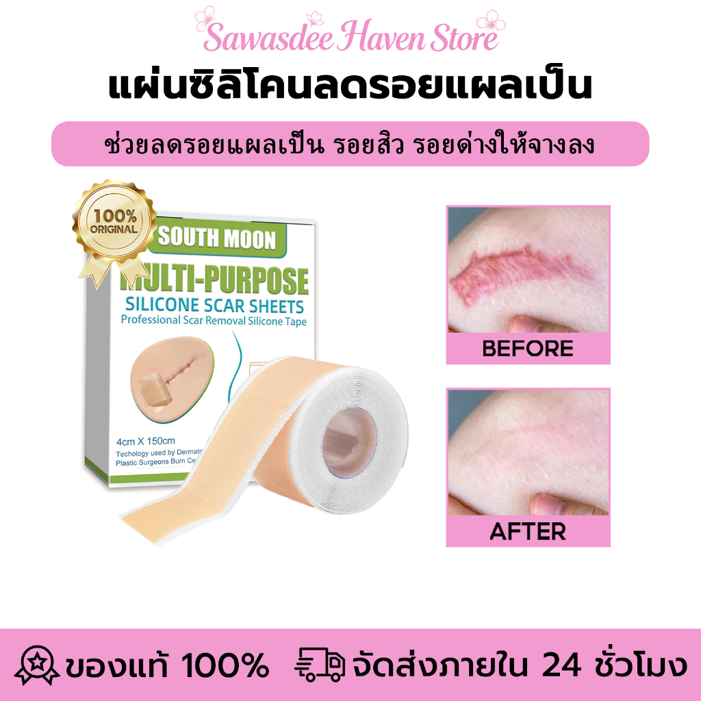 South Moon silicone scar sheet รักษารอยแผลเป็น แผ่นแปะแผลเป็น กําจัดรอยแผลเป็นจากแผลเป็น เผยผิวเนียนสวย