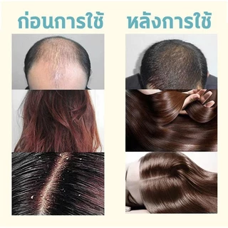ของแท้100%🌱แชมพูขิง 500ML+ เซรั่มขิง แก้ผมร่วงบำรุงผมและหนังศรีษะ