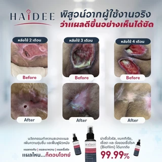 HAIDEE SKIN NOURISHING WATER ฮายดี้ สกิน เนอริชชิ่ง วอเตอร์ สเปร์พ่นแผลกดทับ แผลตื้น แผลลึก แผลเป็นโพรง