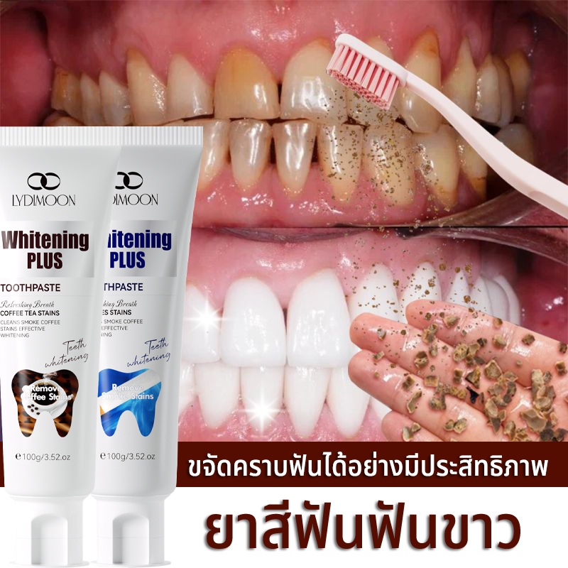 LYDIMOON ยาสีฟันฟันขาว 100g ฟันขาว ช่วยลด หินปูน ฟันเหลือง ลดกลิ่นปาก ปกป้องเหงือก | ยาสีฟันสมุนไพร 