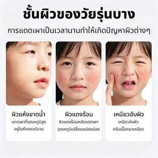 ครีมทาหน้าเด็ก 12 ปี+ บรรเทาผิวแดง-ร้อนจากแดด พร้อมเติมความชุ่มชื้น สดชื่นใน 30 วิ ใช้หลังออกแดด หรือเช้า-เย็น
